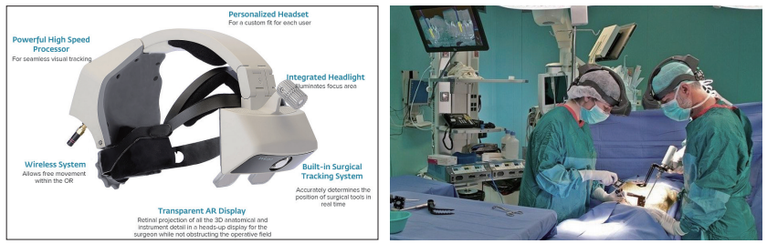 그림 2 xvision AR HMD 및 수술 적용 사례